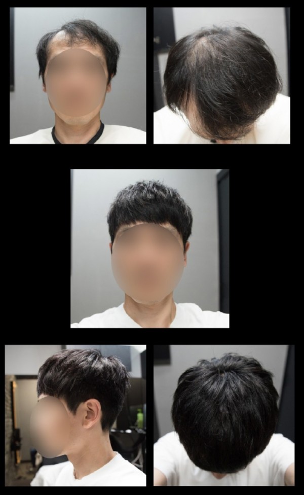 thumb-1935030418_4kS7awKs_7a8eae8f0fe99b7d5b3bae01bc3addf85649da7c_835x1357.jpg